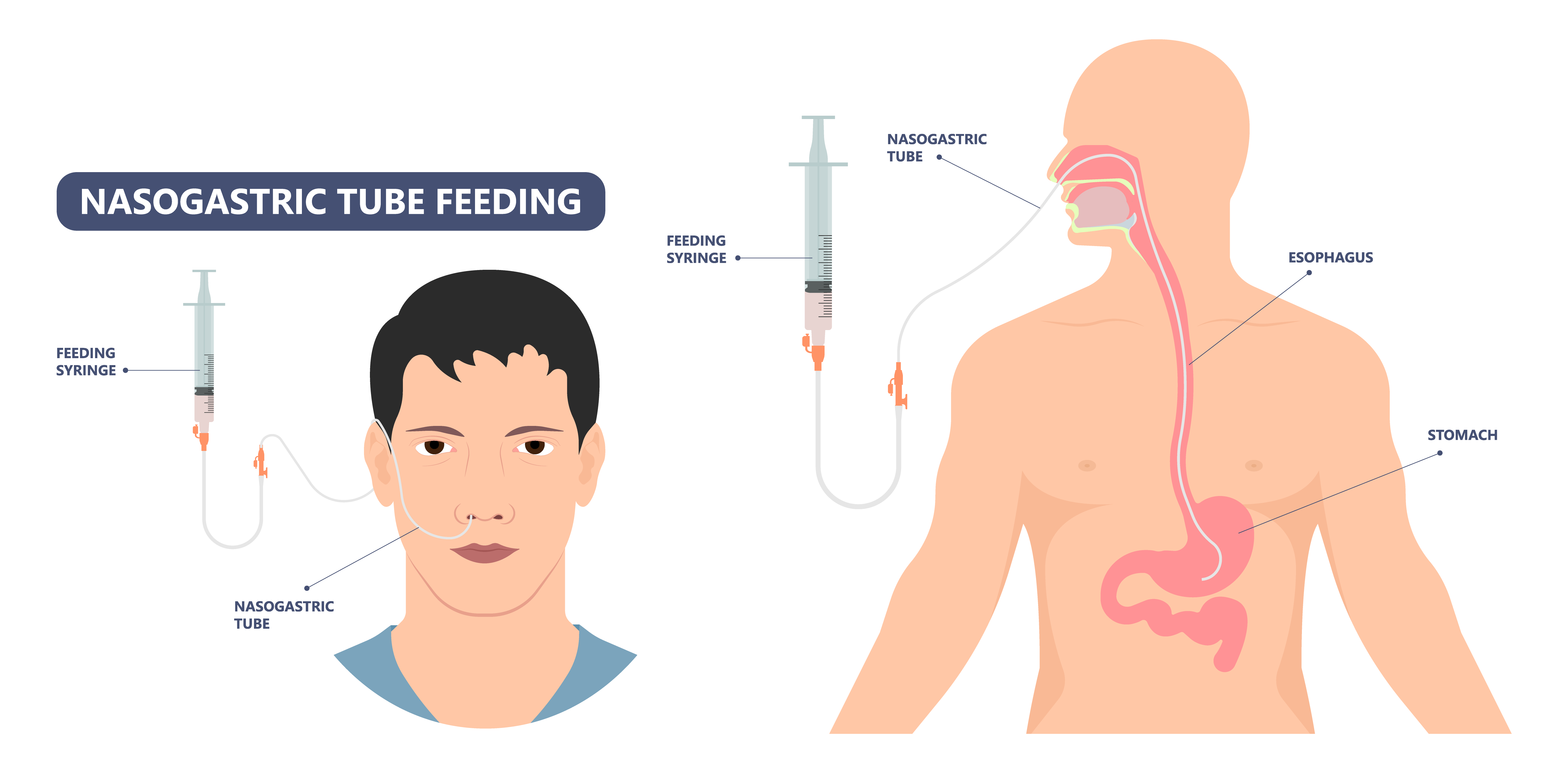 GULF KEN Obesity Treatment | Dubai Gastroenterology Clinic